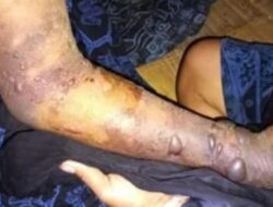 7 Warga Badui Meninggal Akibat Gigitan Ular Tanah