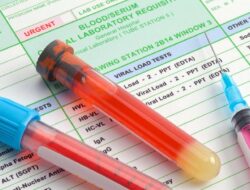 Deretan Golongan Darah Langka di Dunia, Ada ‘Bombay Blood’